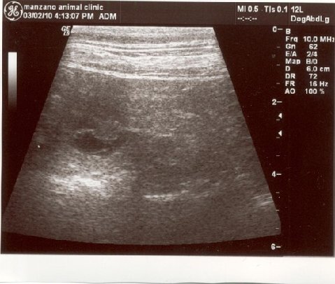 Ultrasound at 25 days